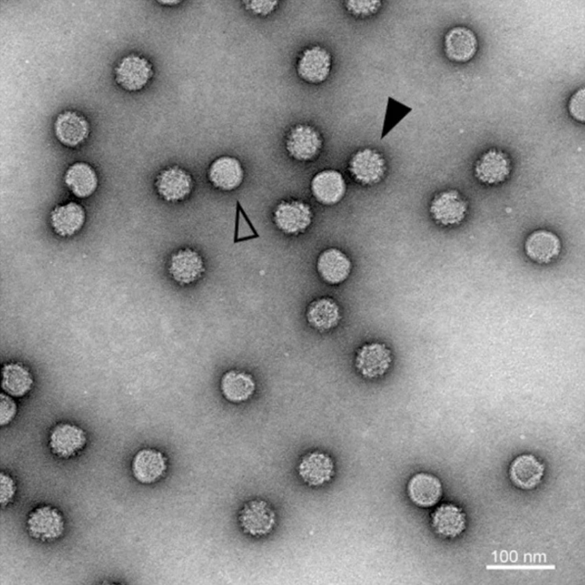 Microscope image of the chimeric dengue and Binjari virus particles at ×30,000 magnification